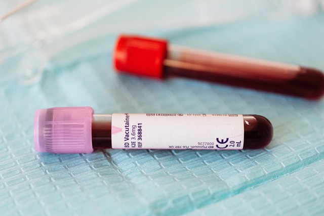 venepuncture haemochromotosis centrifuge private blood services